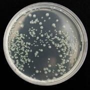 TSA bakterie och svamp test